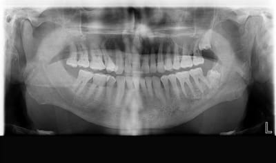 Panoramiquebellrd20103 zgyror - Eugenol