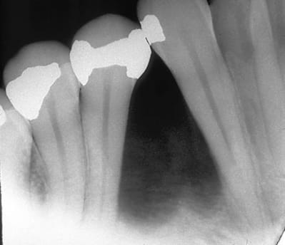Paro1 tn8dyt - Eugenol