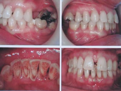 Paro photo pyivjc - Eugenol