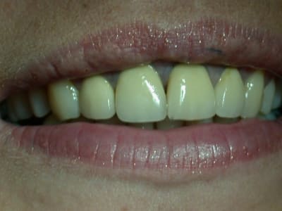 Pas1 gz5djh - Eugenol