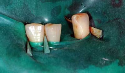 Pdt01 ze2096 - Eugenol