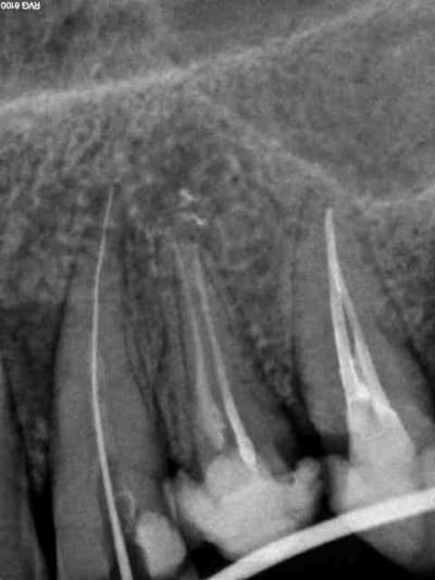 Per op kjzbro - Eugenol