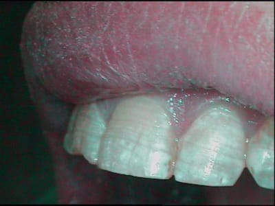 Pere hw7tpw - Eugenol