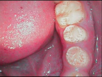 Petite 1 w8fhym - Eugenol