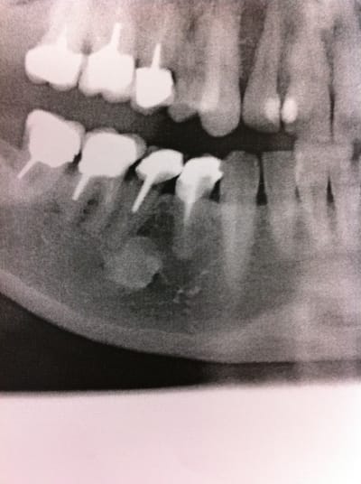 Photo1 xxlxko - Eugenol
