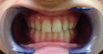 Photo 1 10  gzenqs - Eugenol