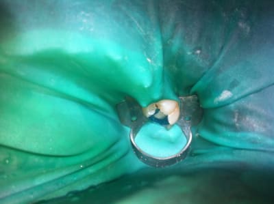 Photo 1 gvoule - Eugenol