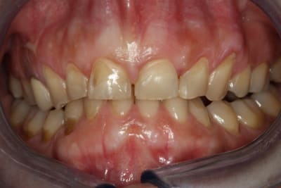 Photo 2 wpvas9 - Eugenol