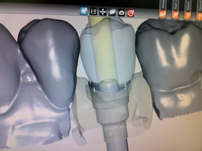 Photo 3 hxymk5 - Eugenol