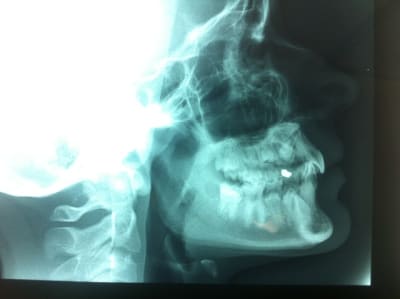 Photo 4 plqnqk - Eugenol