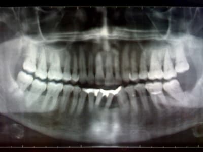 Photo ep5iku - Eugenol