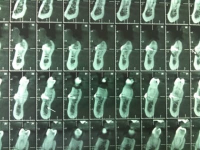 Photo jjan5k - Eugenol