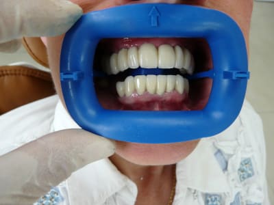 Pi ce numero tsx4cf - Eugenol