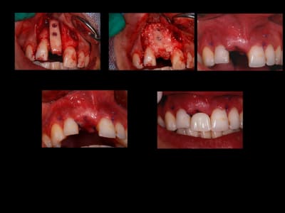 Planche2 awlu7r - Eugenol