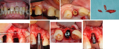 Planche 1 muq92k - Eugenol