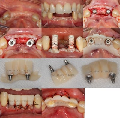 Planche 2 wp6d2g - Eugenol