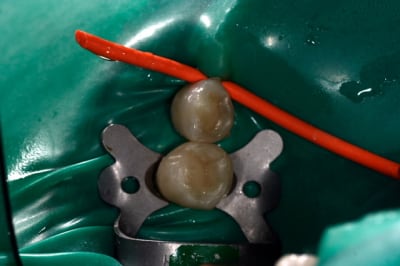 Point de contact myvjtj - Eugenol