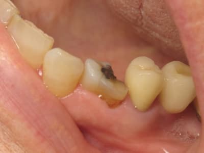 Pompom14 001 ps6a3r - Eugenol