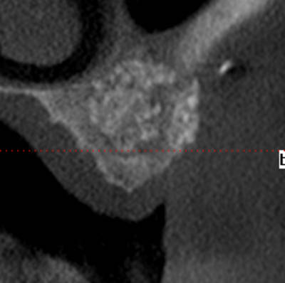 Post1 y45ukn - Eugenol