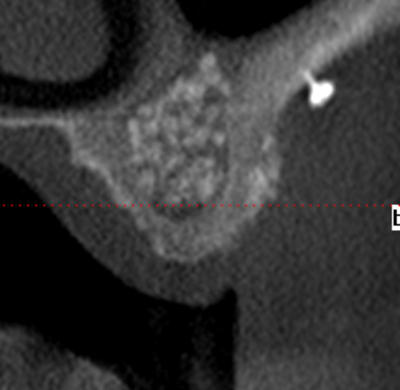 Post2 caxl5b - Eugenol