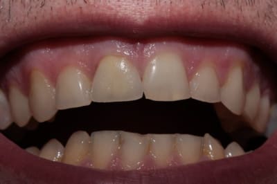 Post op j 0 iqf6tl - Eugenol