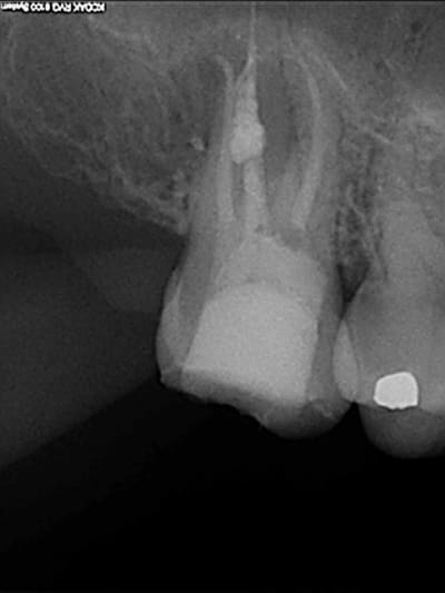 Post op rte   mta 2007 j9n6jh - Eugenol