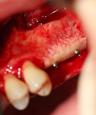 Pouy 011 vwocfs - Eugenol