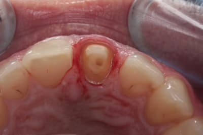 Pr paration  3  rl638m - Eugenol