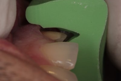 Pr paration anht4q - Eugenol