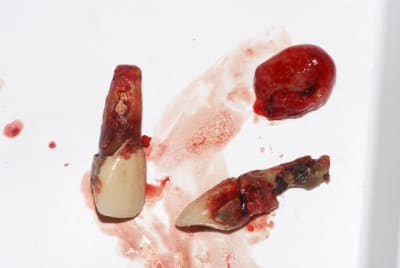 Pre b fmeghf - Eugenol