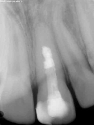 Pre lq9ott - Eugenol