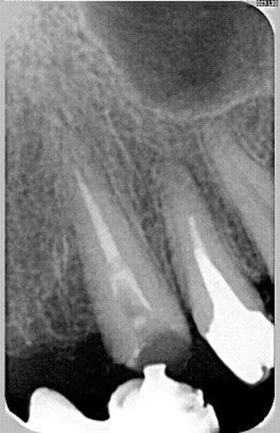 Preop vk1xpu - Eugenol
