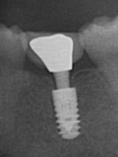 Prf ut4qgk - Eugenol