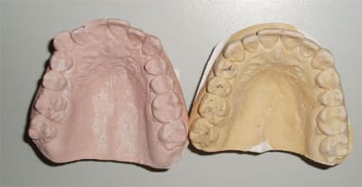 Prign augoov - Eugenol