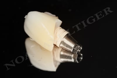 Provisoire flriey - Eugenol