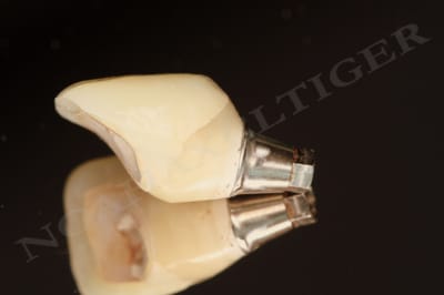 Provisoire rebas  w9dn4w - Eugenol