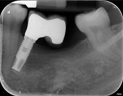 Q1ss6xxlvzb88fue1m7q - Eugenol