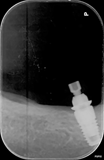 Q7aedqccspkecaruktwdwhksfa5l - Eugenol