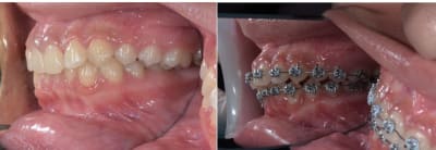 Qcaoppfitbgonfwthmt3 - Eugenol