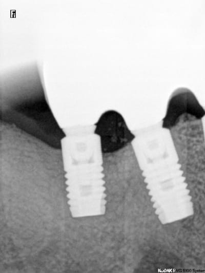 Qqmoislater ddwjjd - Eugenol