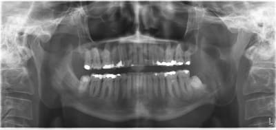 R8lfspj6dhtgphmnxpc2 - Eugenol