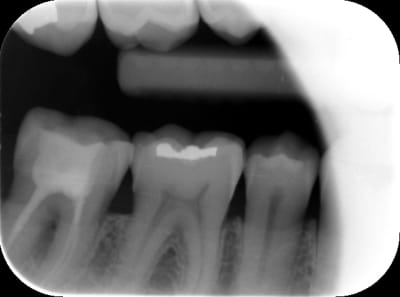 Rad 08 ftydeo - Eugenol