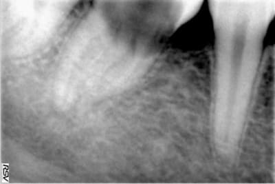 Radio2 j5drvk - Eugenol