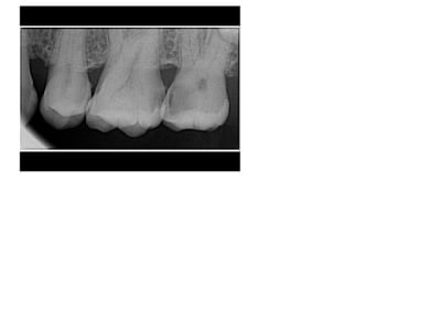 Radio 1 r0hxv8 - Eugenol