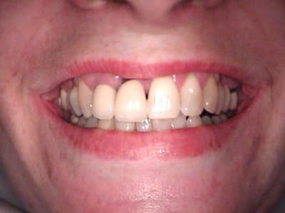 Recession1 rdsvue - Eugenol