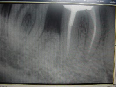 Retro0301 j2jptq - Eugenol