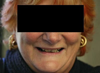 Rire face ryl3ns - Eugenol