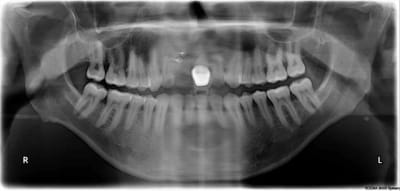 Ro1 v136zs - Eugenol