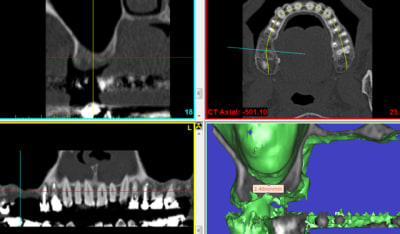 Ro4 cuw516 - Eugenol