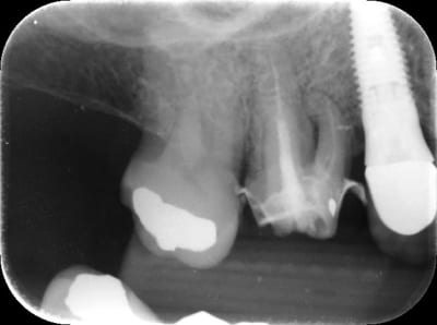 Rob3 emc2tr - Eugenol